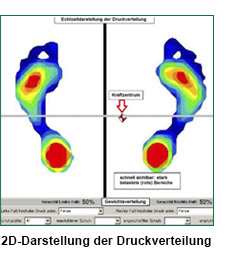 2D-Darstellung der Druckverteilung