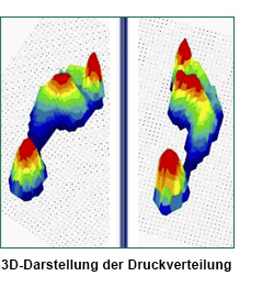 3D-Darstellung der Druckverteilung