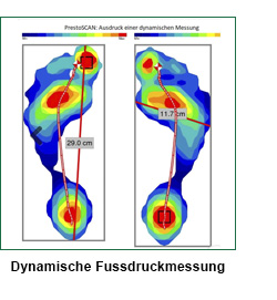 Dynamische Fussdruckmessung